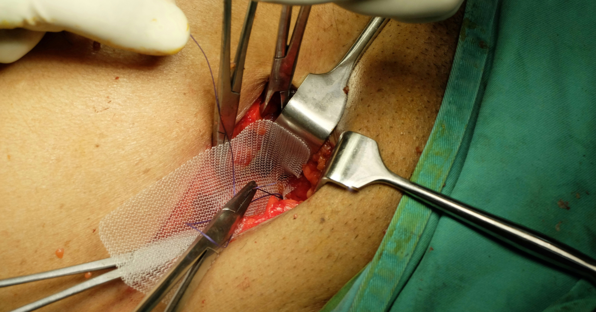 Day Case Surgery