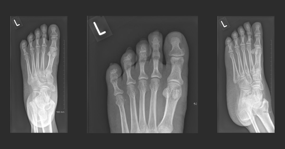 Diagnose This Orthopedic Case?