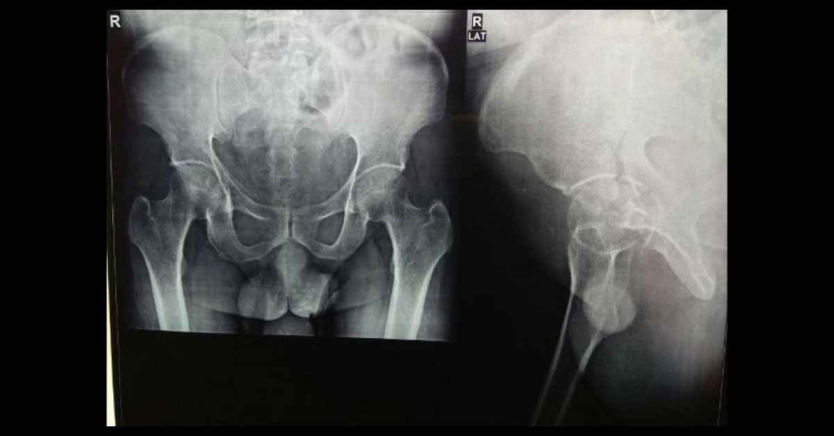 Advise Management For This Accident Case