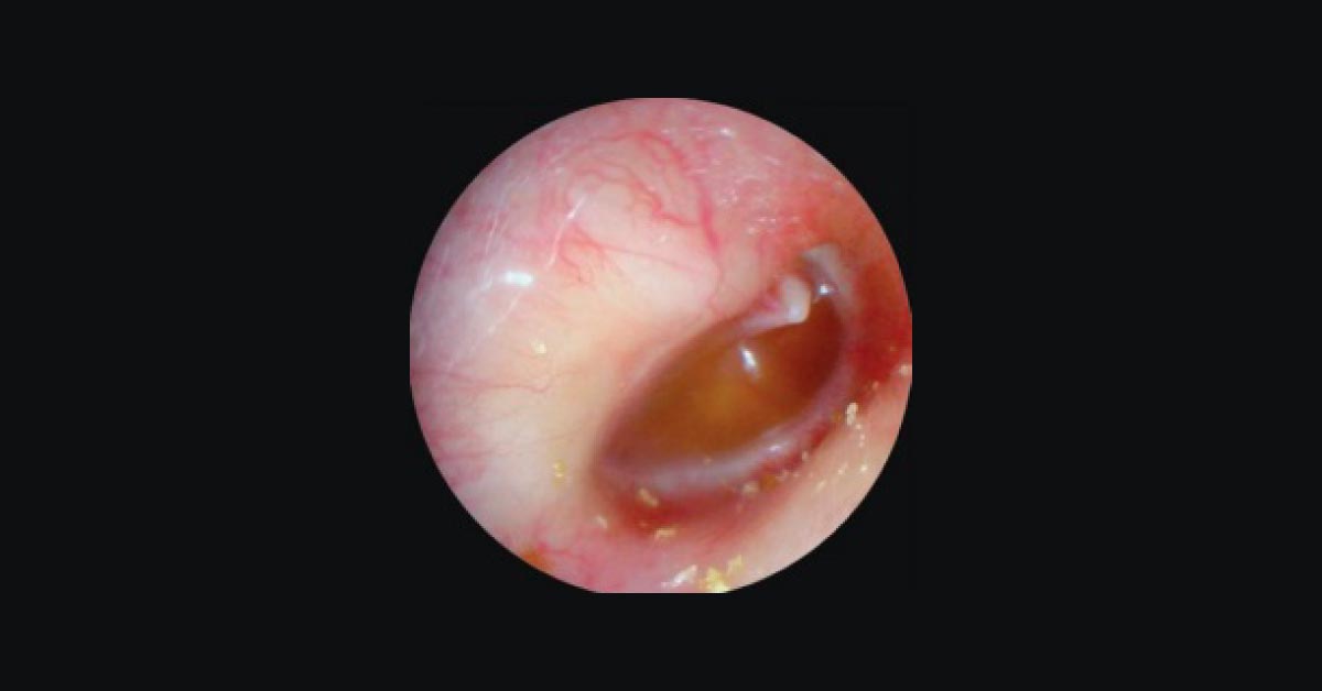 Diagnose The Condition
