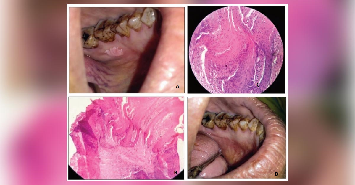 Can You Diagnose This Condition?