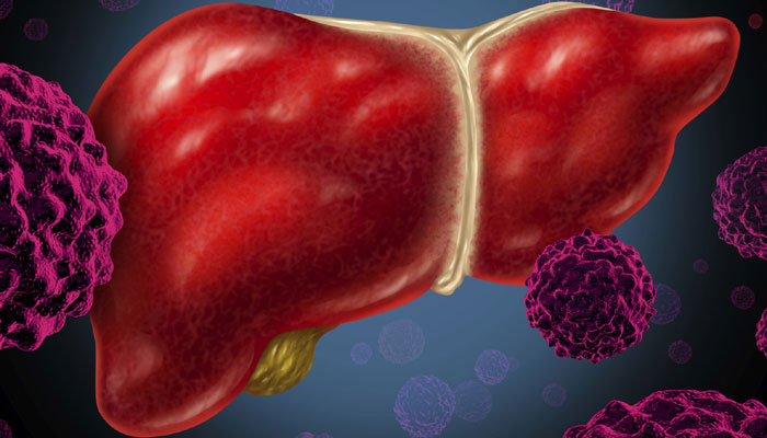 New Blood Test Can Detect Liver Damage Even Before Symptoms Appear