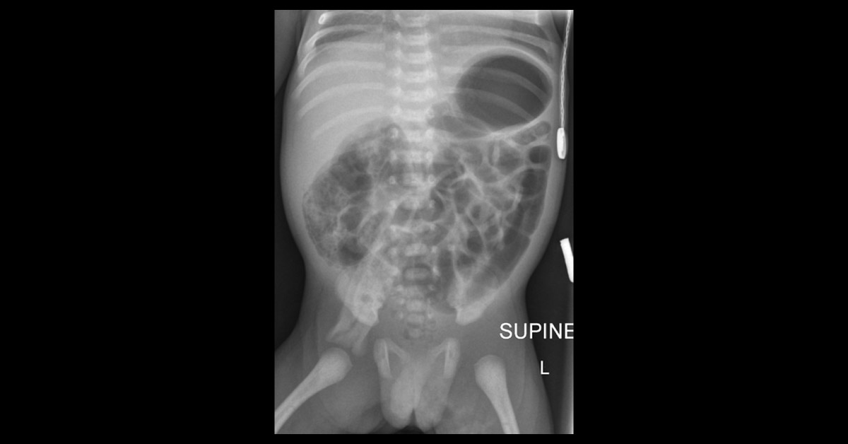 Interpret The X-Ray Image