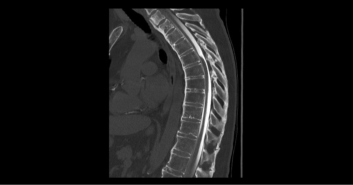 Diagnose This Neurology Case?