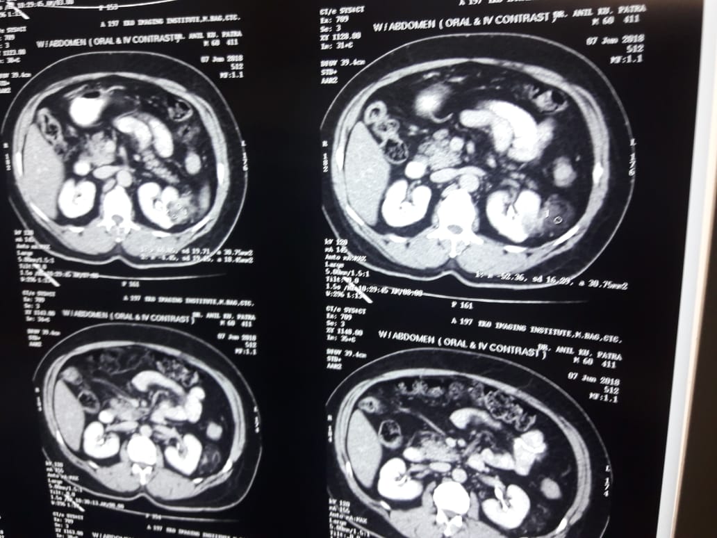 How To Manage This Case?