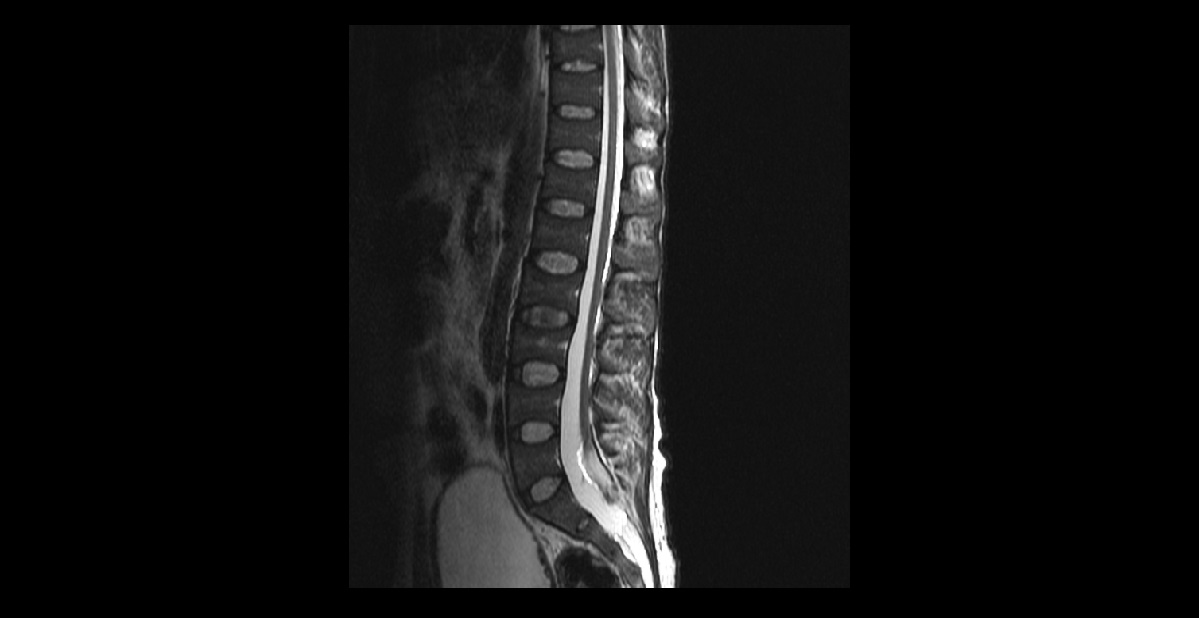 Diagnose This Pediatric Case?