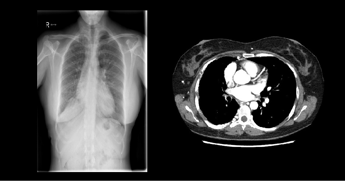 Find the Congenital Abnormality?