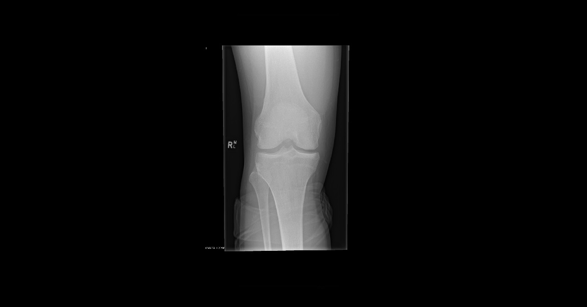 Diagnose This Injury?
