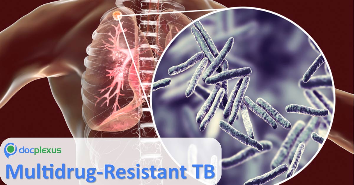 Drug-Resistant TB In India