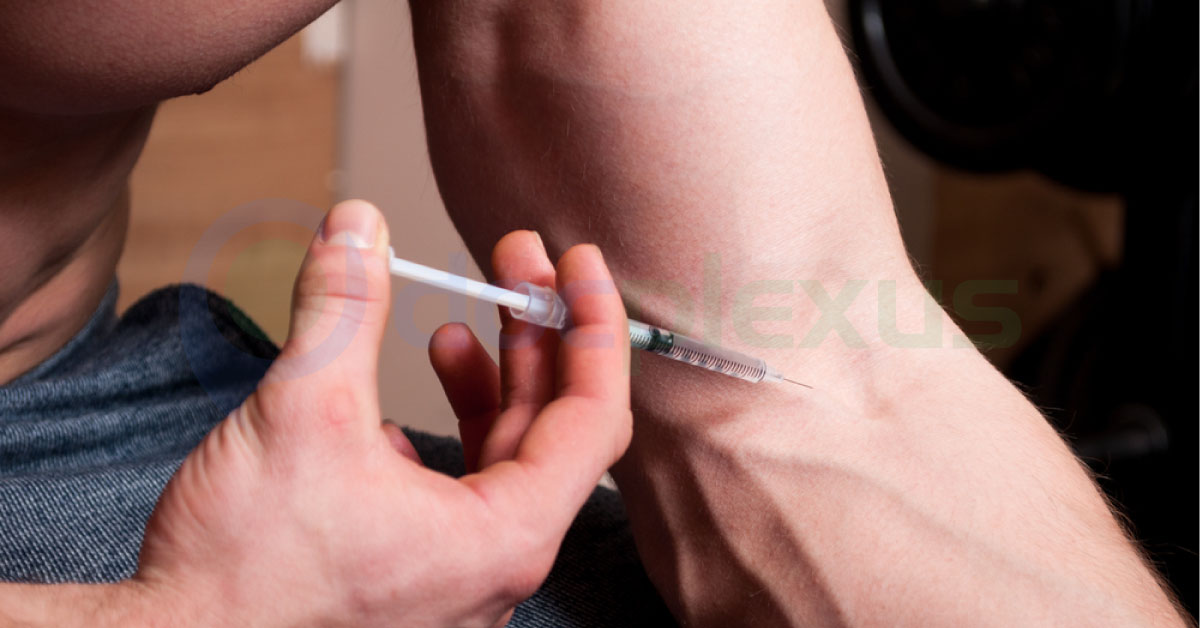 Steroid Abuse