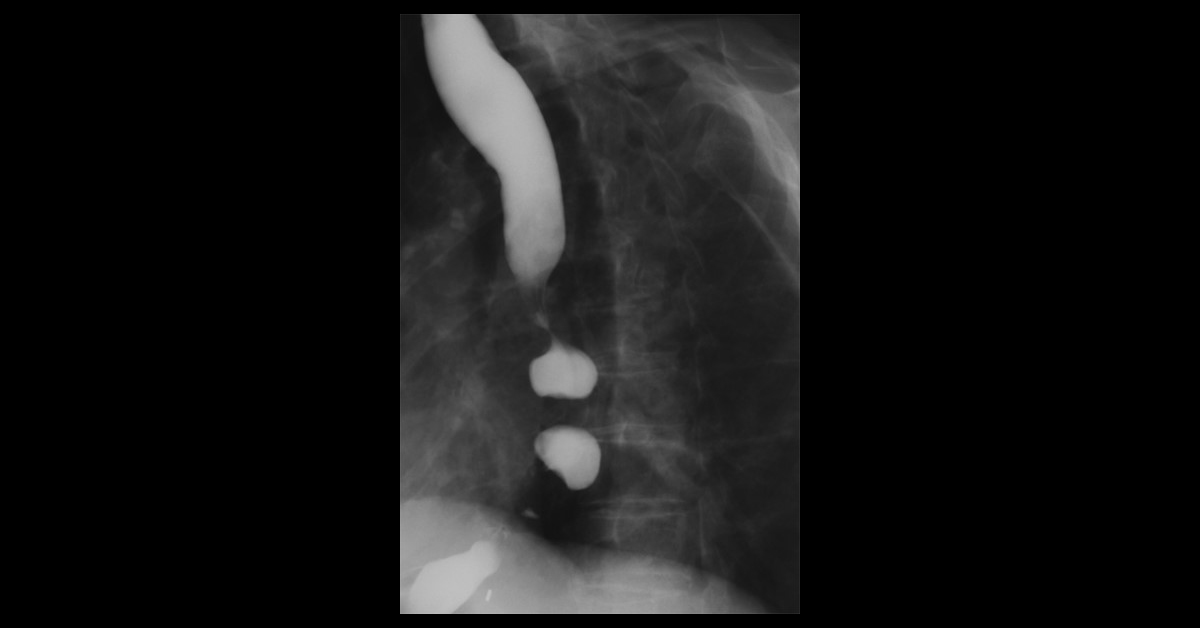Identify The Condition