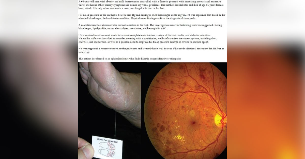 Case Of Diabetes Mellitus