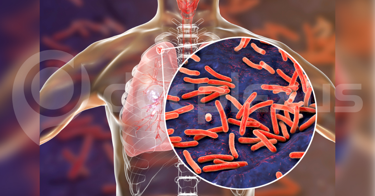 New Simple Test For Diagnosing TB Soon By Government Of India