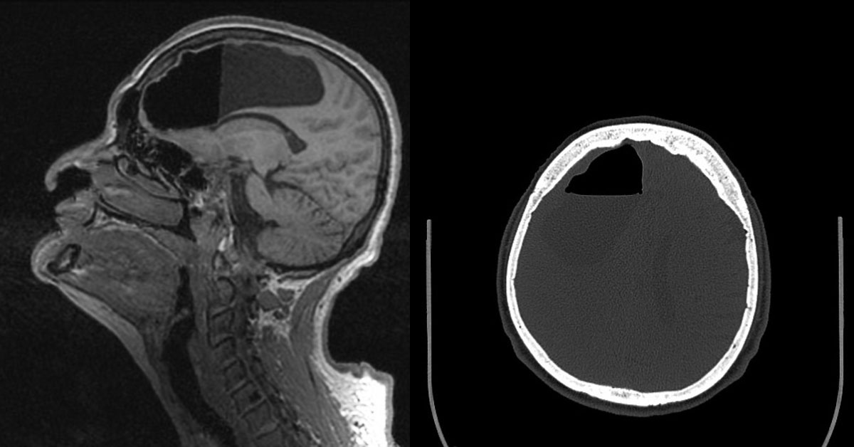 Diagnose The Neurology Case?