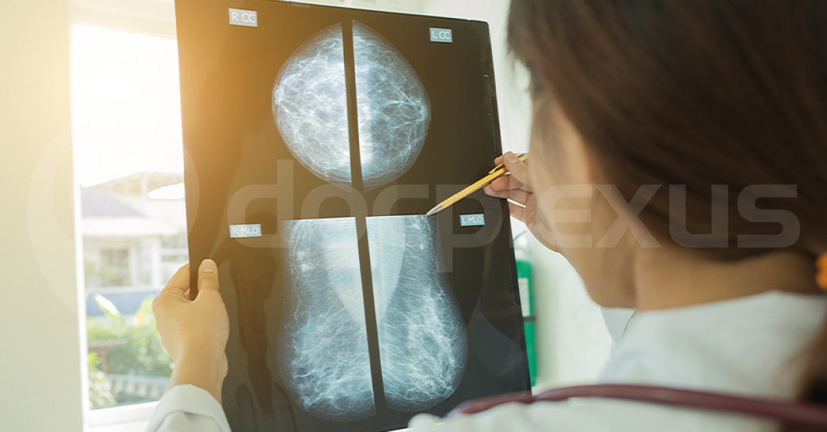 Chemo May Not be Essential In Many Women With Breast Cancer