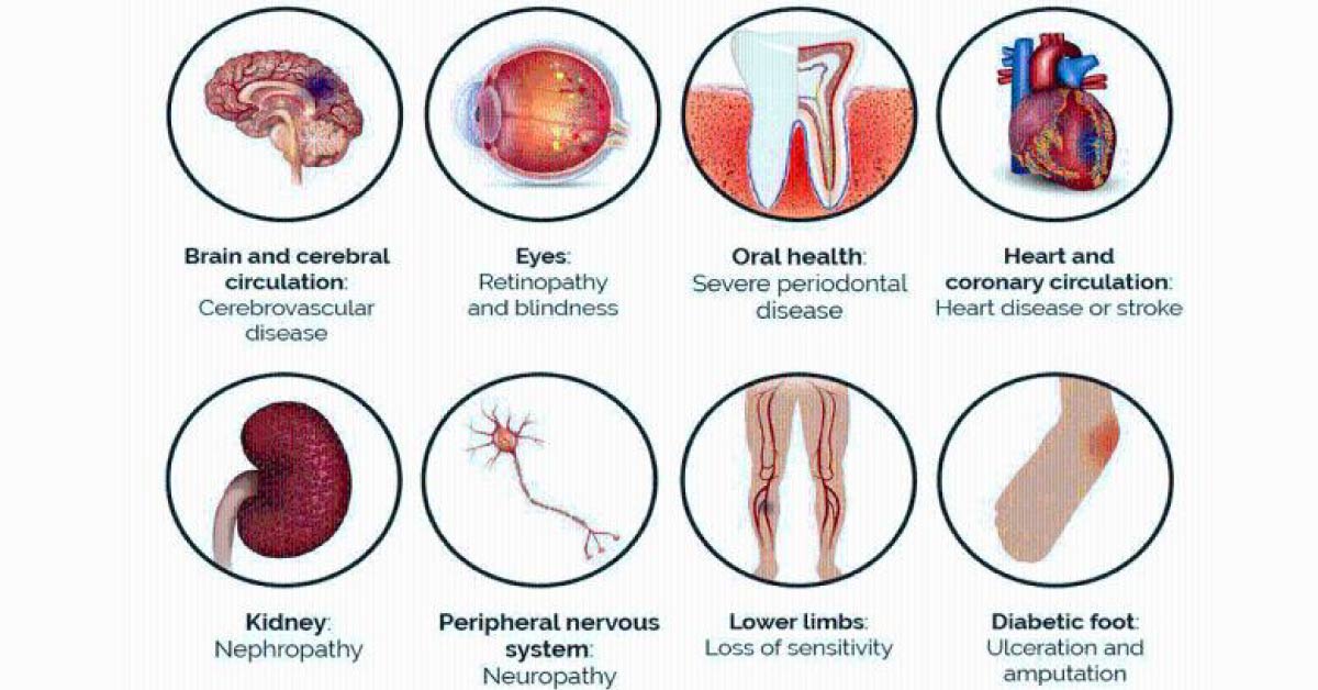 Health Education In Diabetes Mellitus