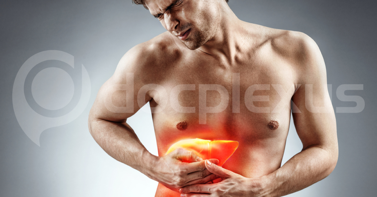 Severe Alcoholic Hepatitis