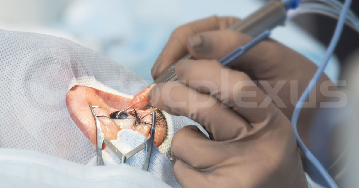 Cataract Surgery Past And Present