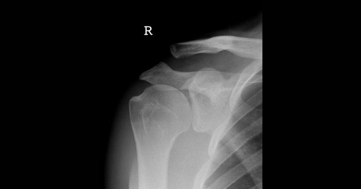 Diagnose The Injury?