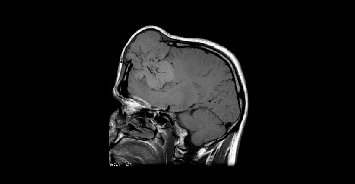 Diagnose The Oncology Case?