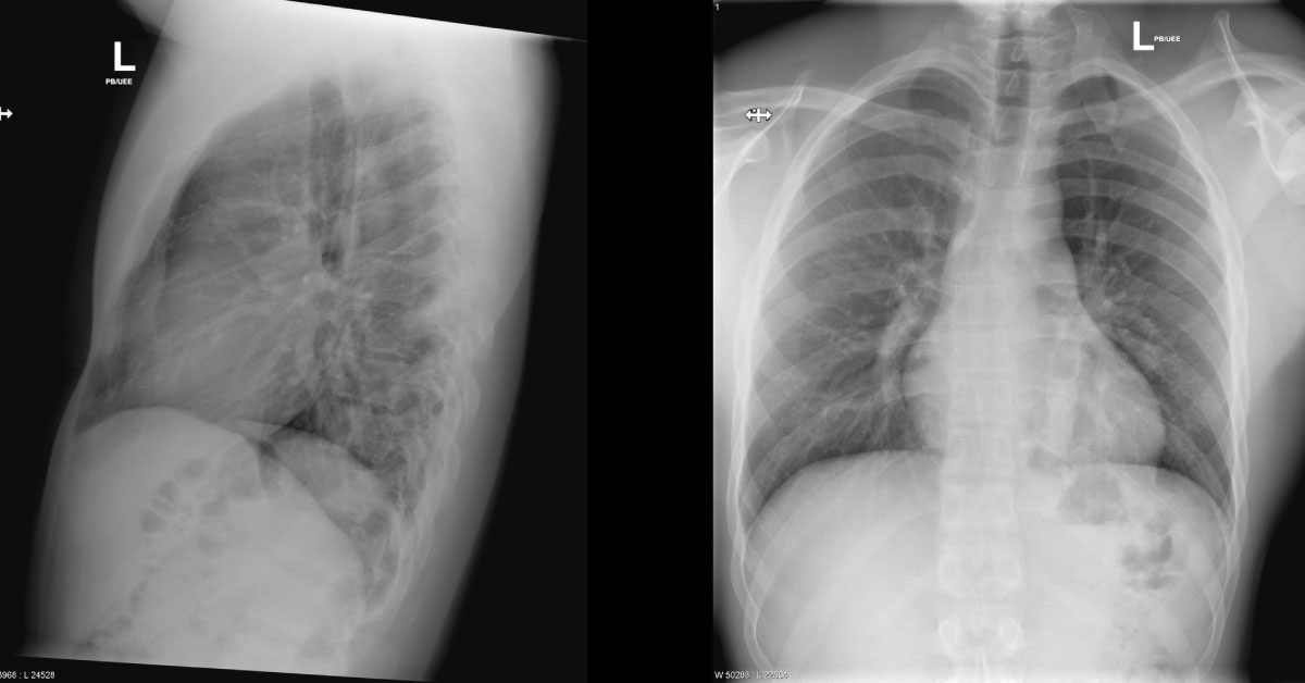 Interpret The X-Ray Image?