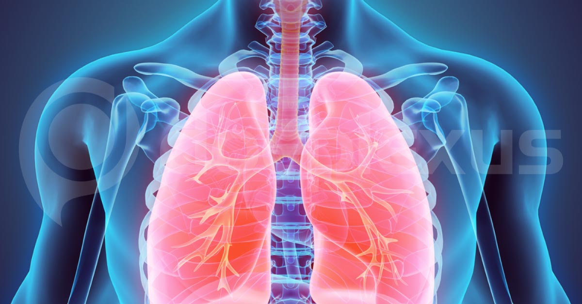 Lung Ultrasound May Be Superior To Chest X-Ray For Diagnosing Lung Complications