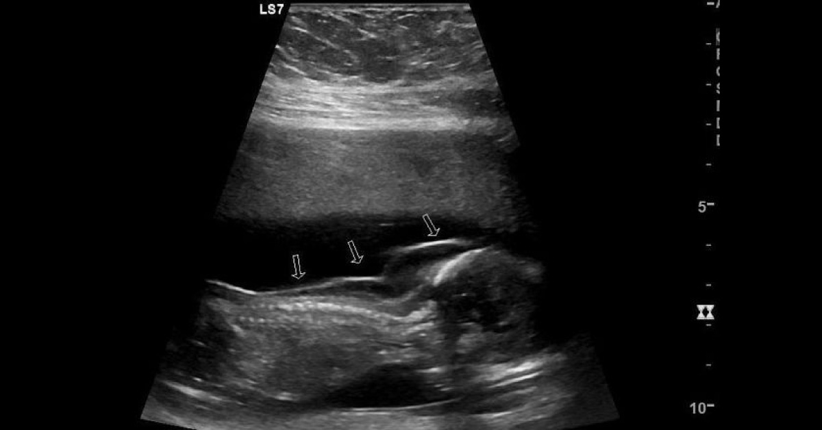 Spot The Diagnosis
