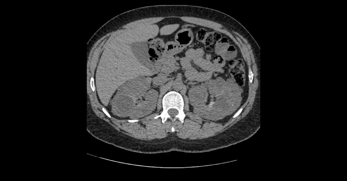 Diagnose This Nephrology Case?