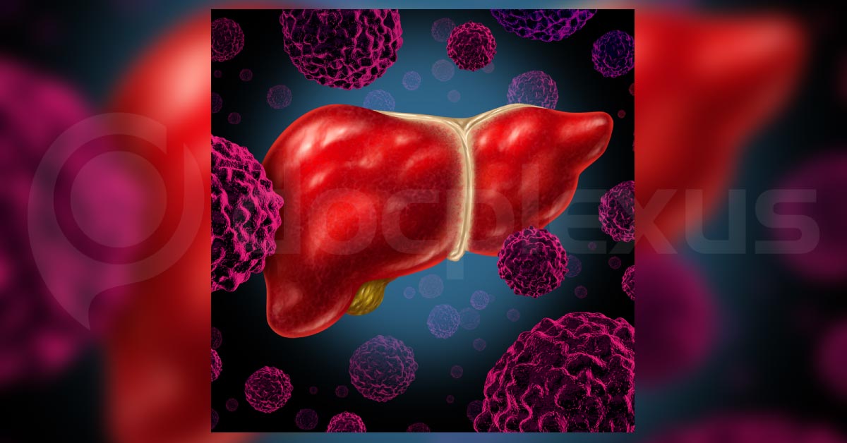 Brief Review On Gallbladder Cancer