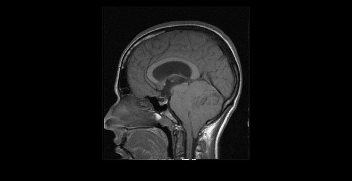 Diagnose This Oncology Case?