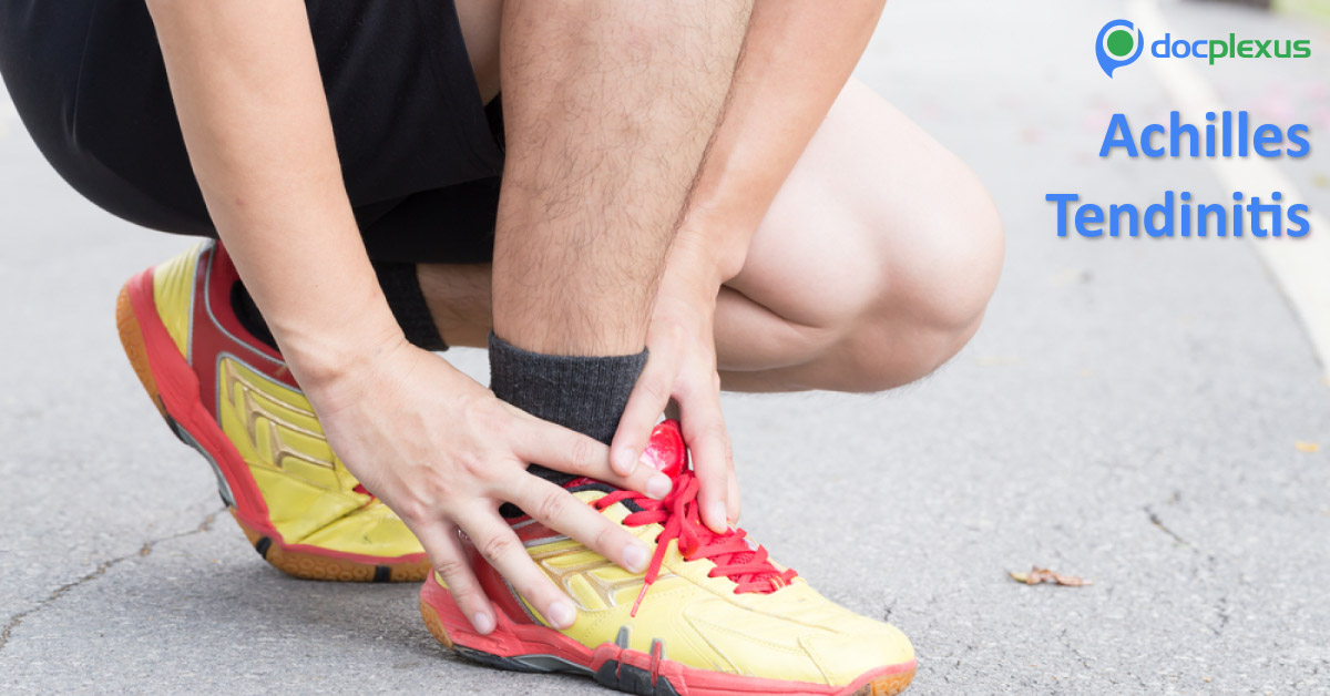 Achilles Pain Management Guideline