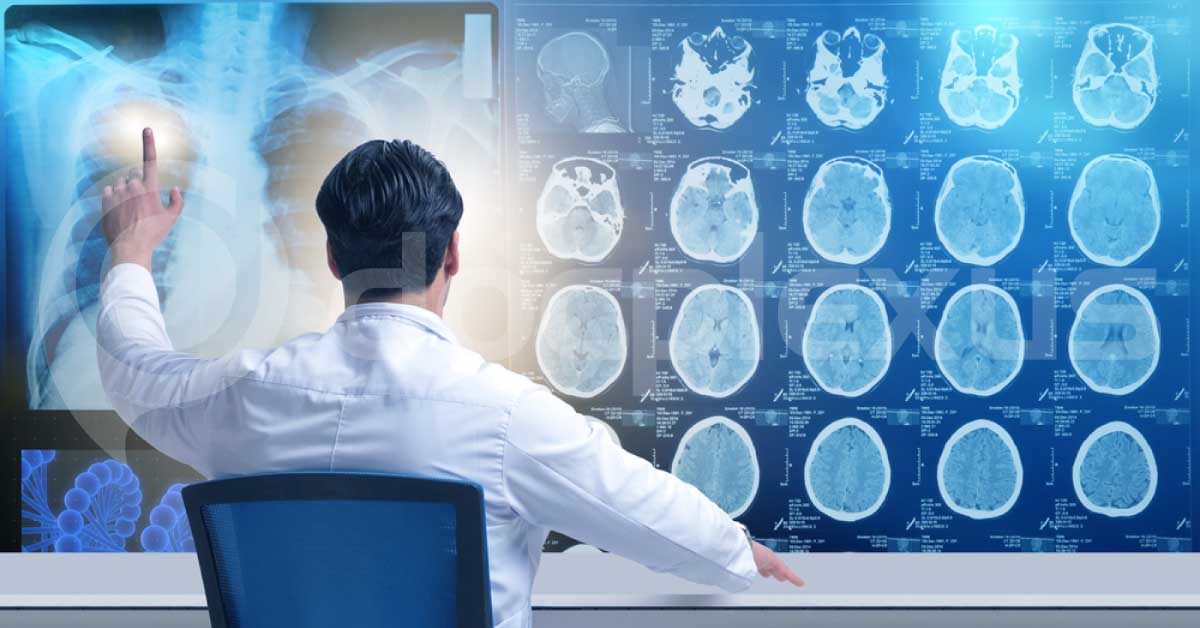 What Will Be The MRI Findings?