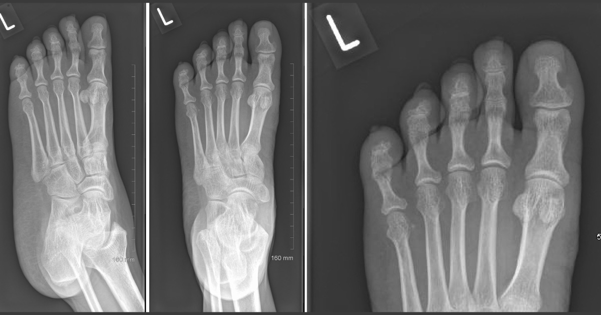 Spot the Diagnosis