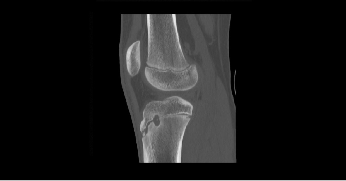 Diagnose This Pediatric Case?