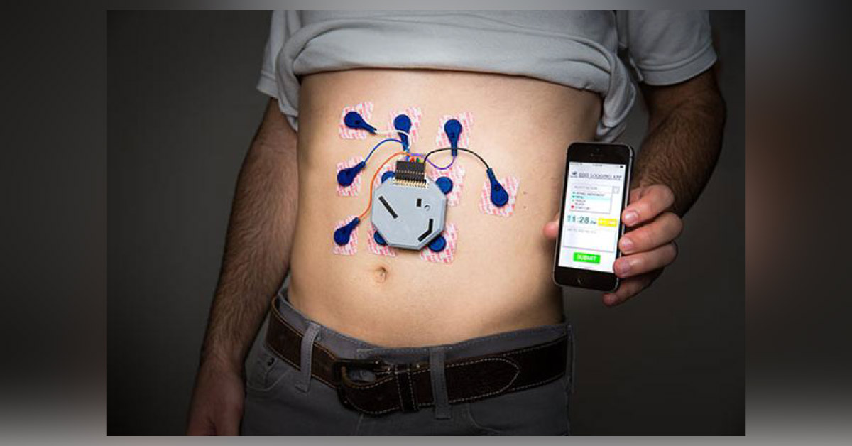 Noninvasive Wearable System To Monitor Stomach Activity Throughout The Day As Holter ECG