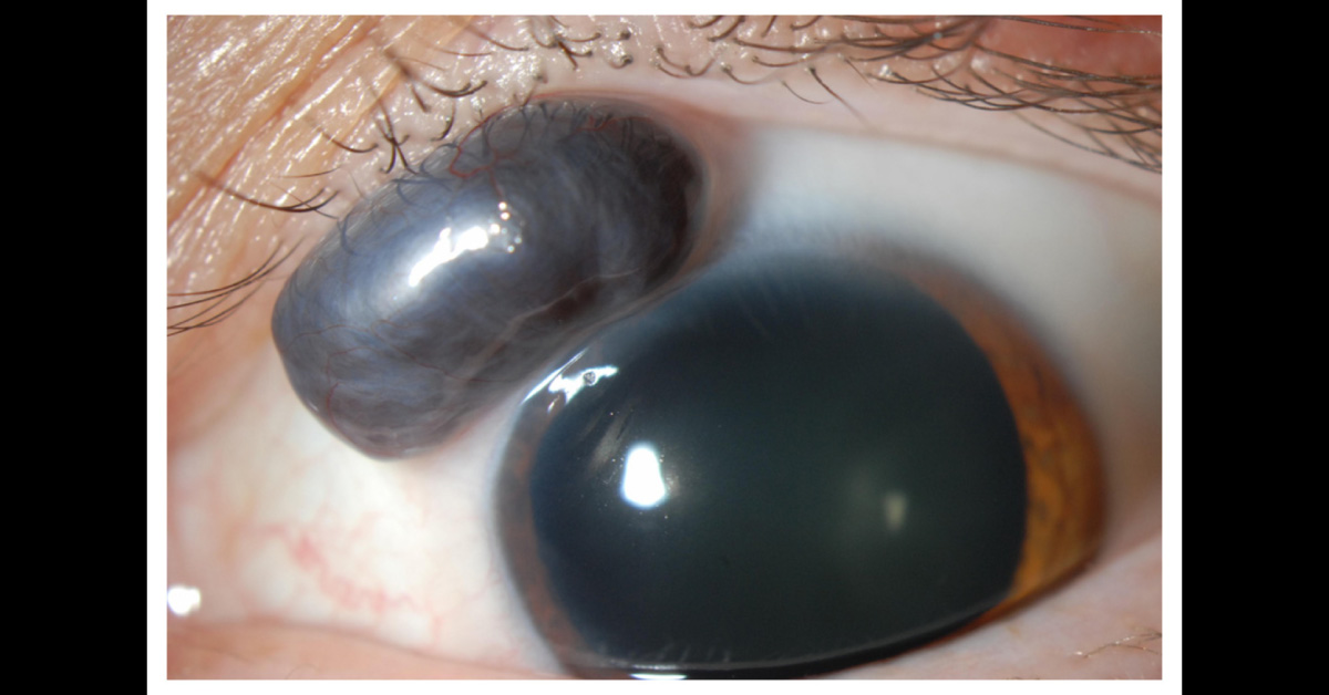 Can You Identify This Disease?