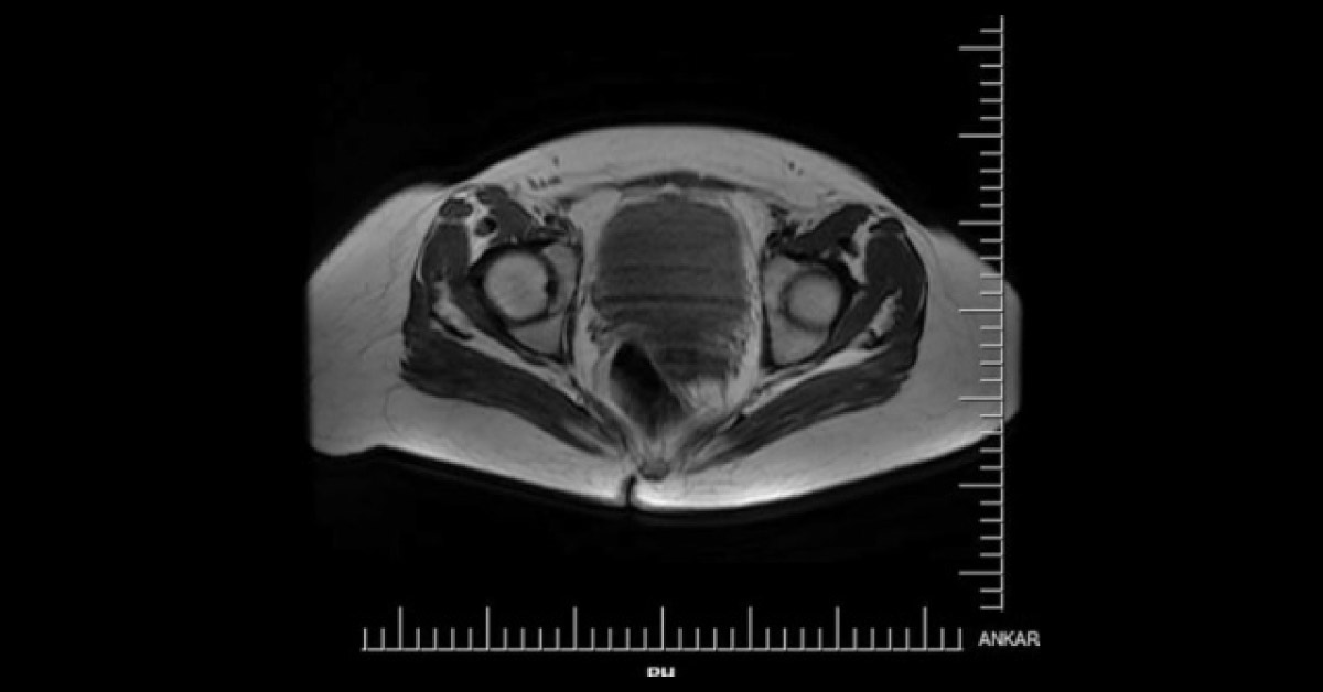 What's Your Diagnosis for This Young Girl?