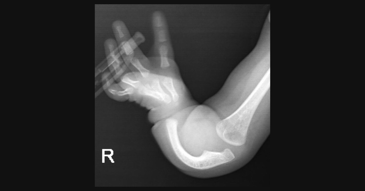 Spot The Diagnosis
