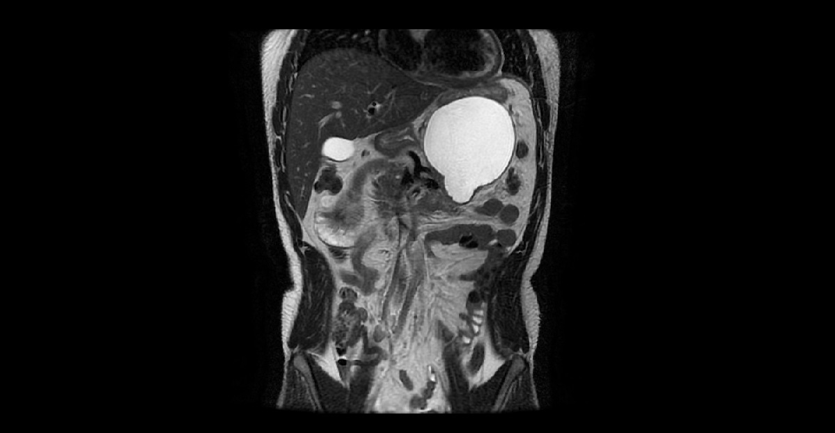 A Man With Abdominal Injury?