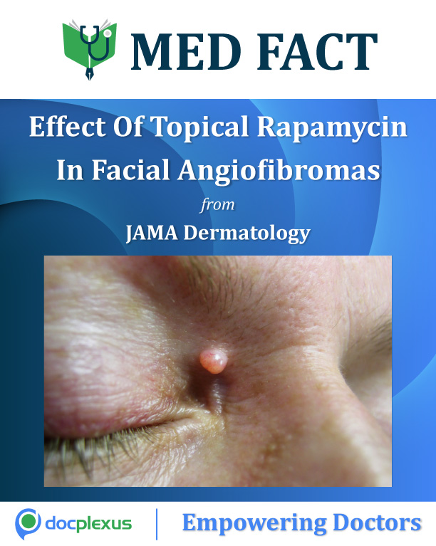 EffectOf Topical Rapamycin In Facial Angiofibromas Secondary To Tuberous Sclerosis