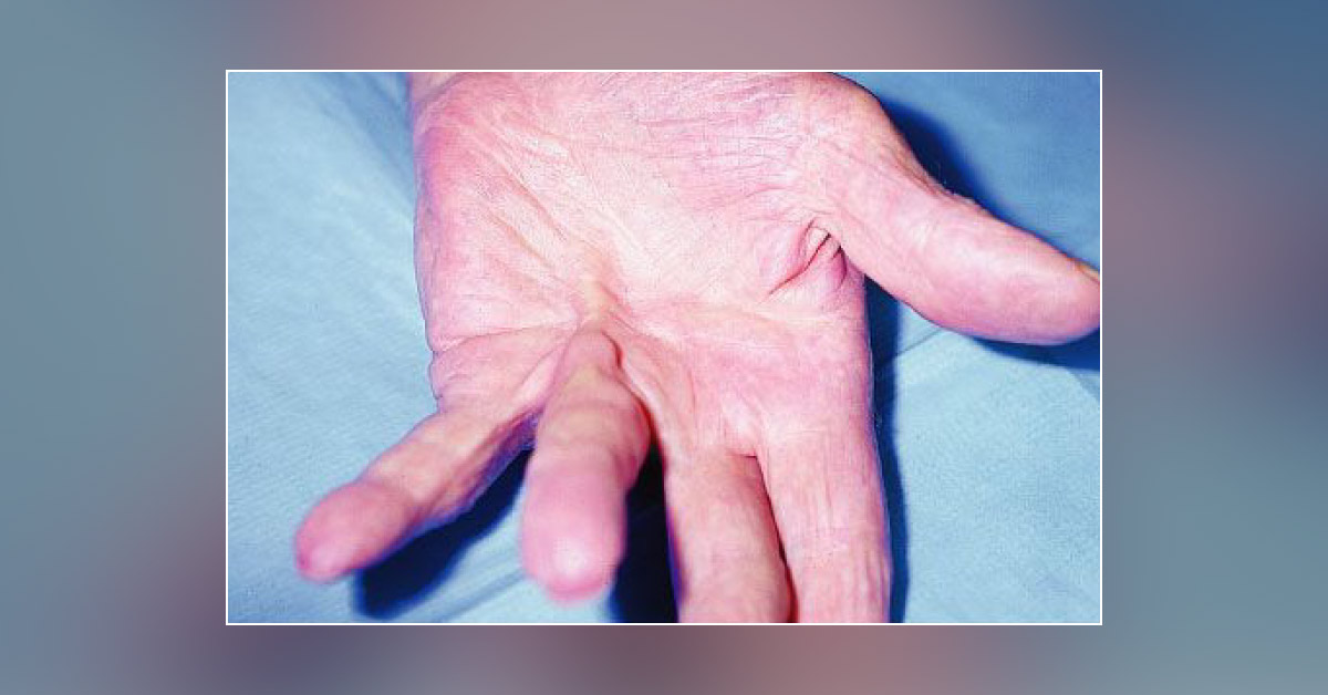 Spot The Diagnosis