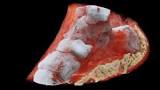 First Ever Colour X-ray Performed On A Human In New Zealand