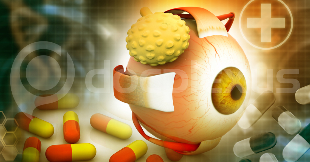 Brief Review On Ocular Manifestations Of Cancer