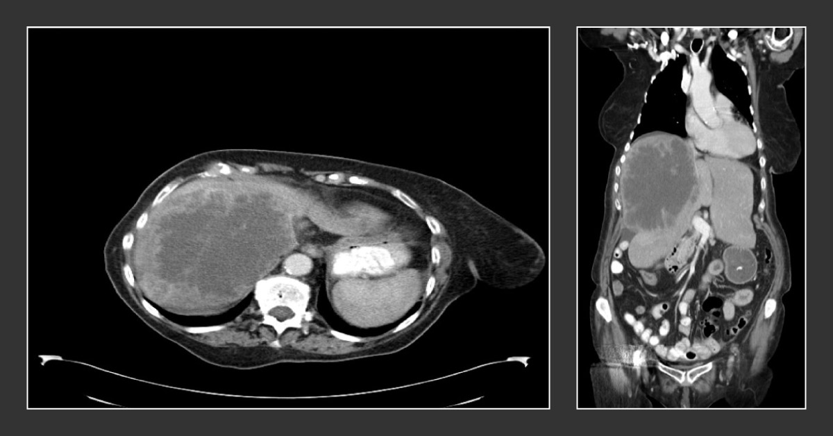 What is the most Probable Plan of Action for This patient?