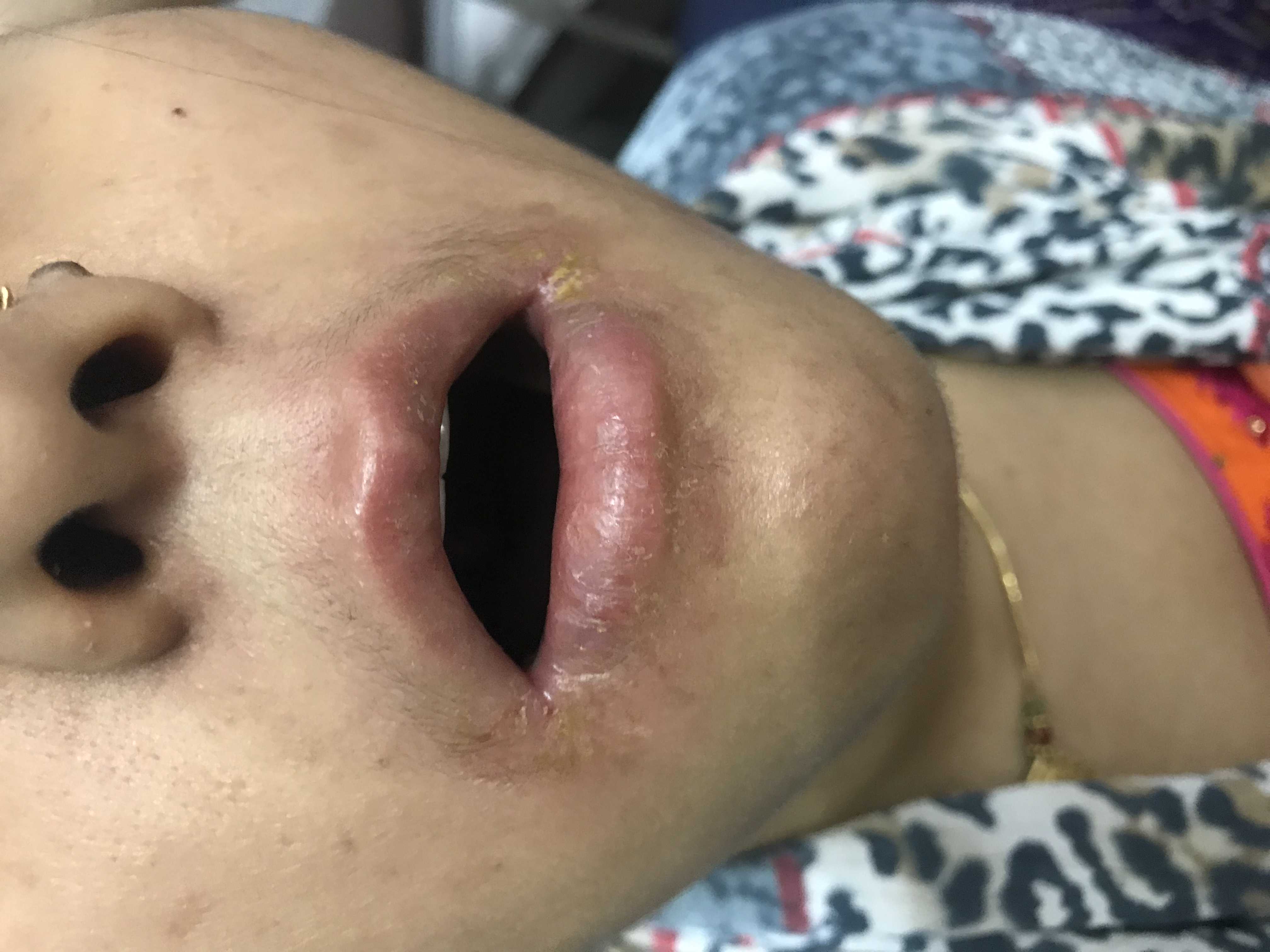 What is this problem to young girl?