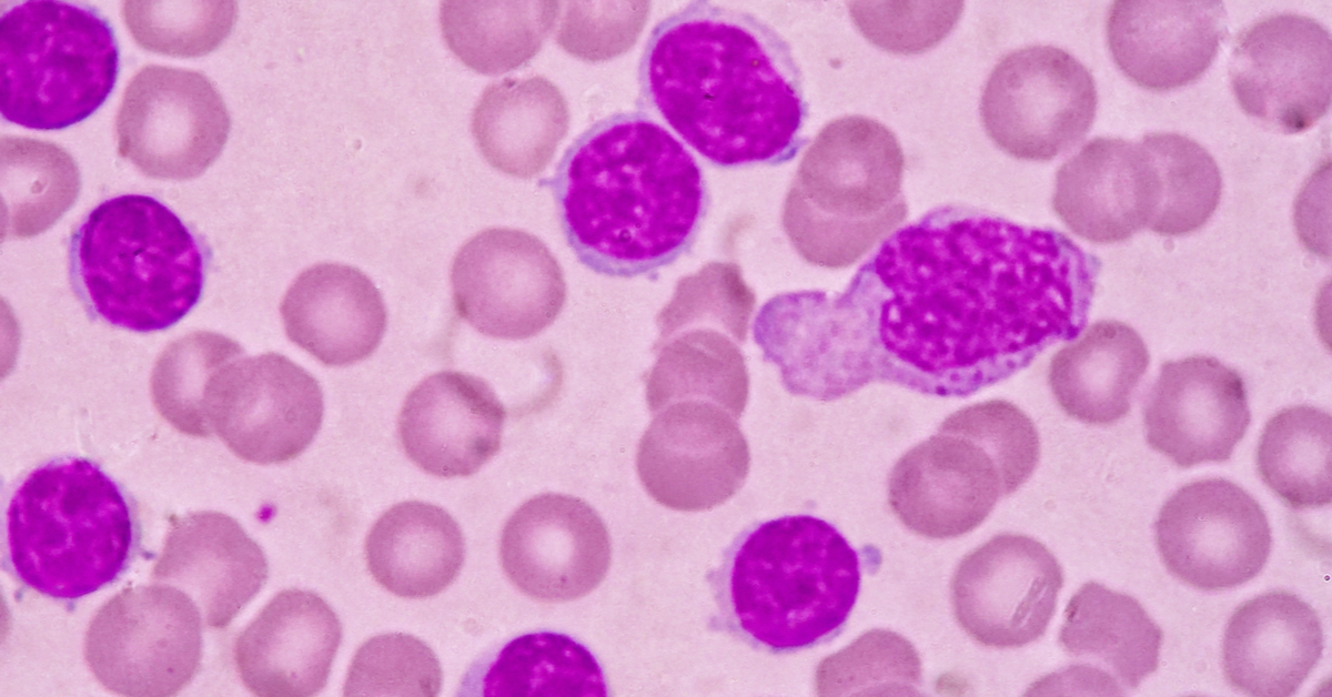 Chronic Myeloid Leukaemia: Frequently Asked Questions