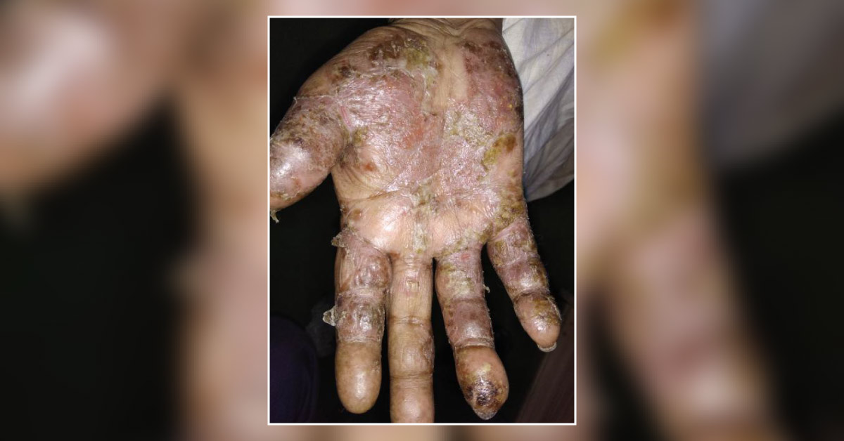 Diagnose the condition?
