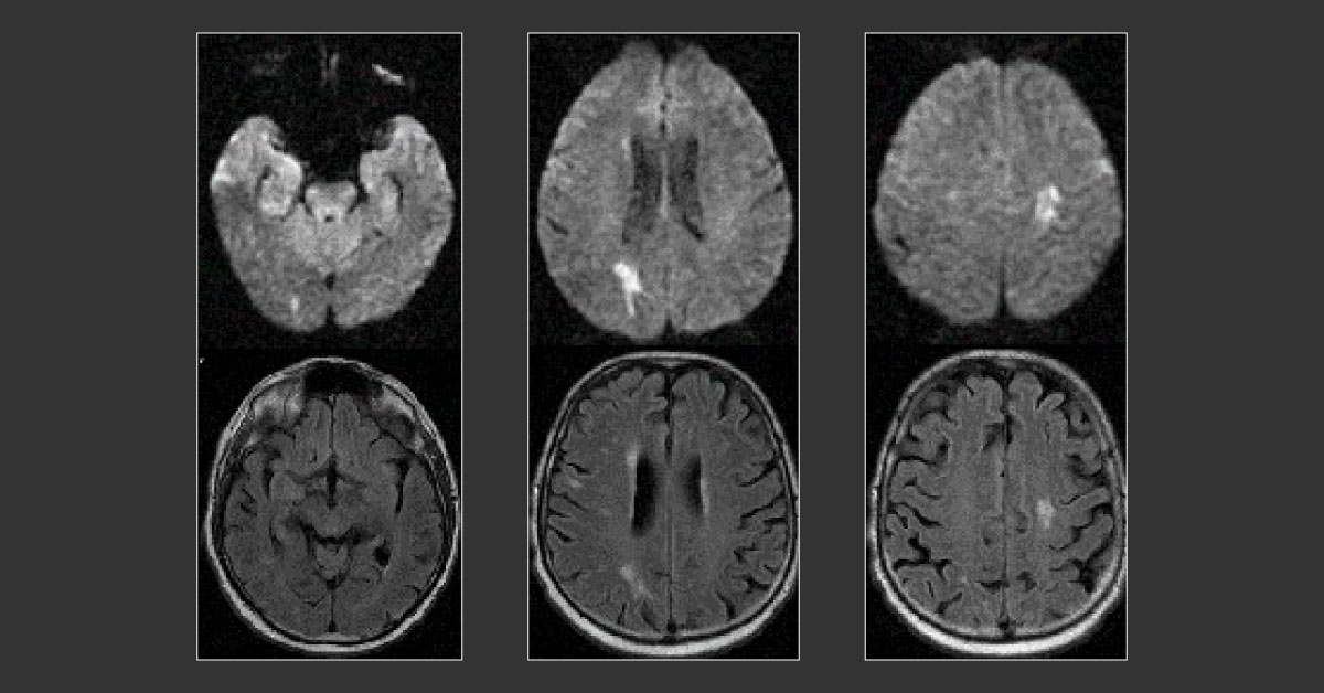 Spot the Diagnosis