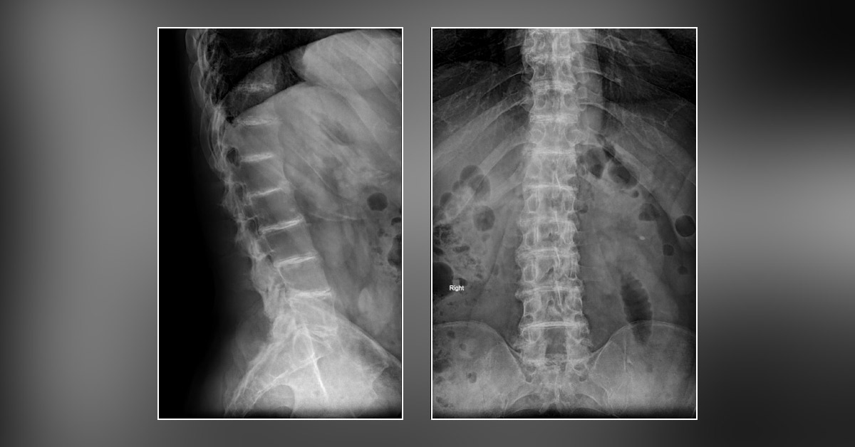 Spot the Abnormality
