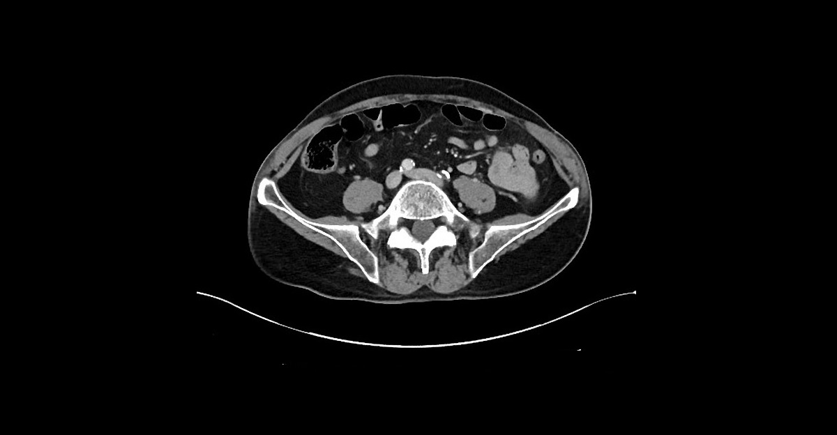Diagnose The Nephrology Case